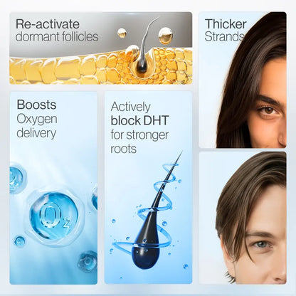 Advanced Hair Density Roll-On Serum - Hair Density Miracle, Anti Hair Fall Scalp Care for Men & Women