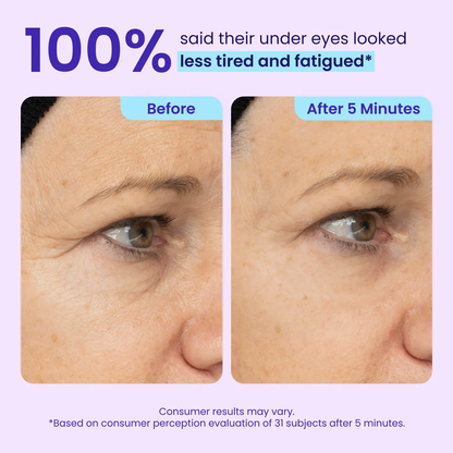 Voezra® Eye Bag Instant Eraser, Tightens, Firms & Blurs Wrinkles