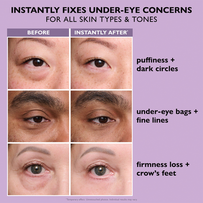 Voezra® Eye Bag Instant Eraser, Tightens, Firms & Blurs Wrinkles